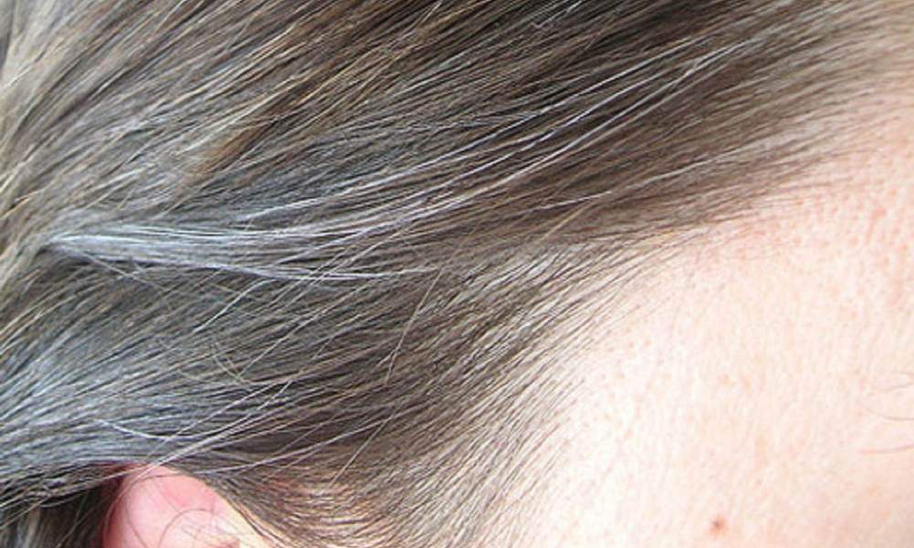 Microbioma del cuoio capelluto: come prendersene cura per capelli sani e forti