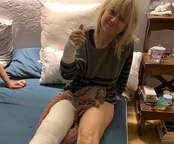 Littizzetto cade in strada, braccio e gamba ingessati