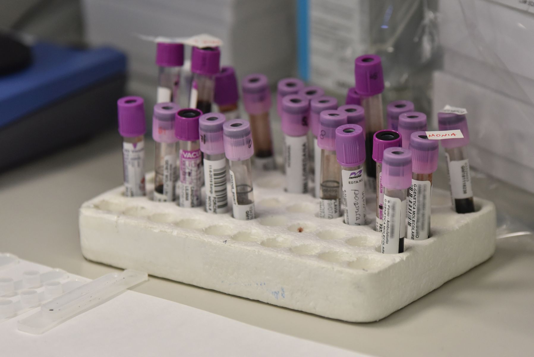 Coronavirus cinese: rientra allarme in Italia, primi casi in Europa