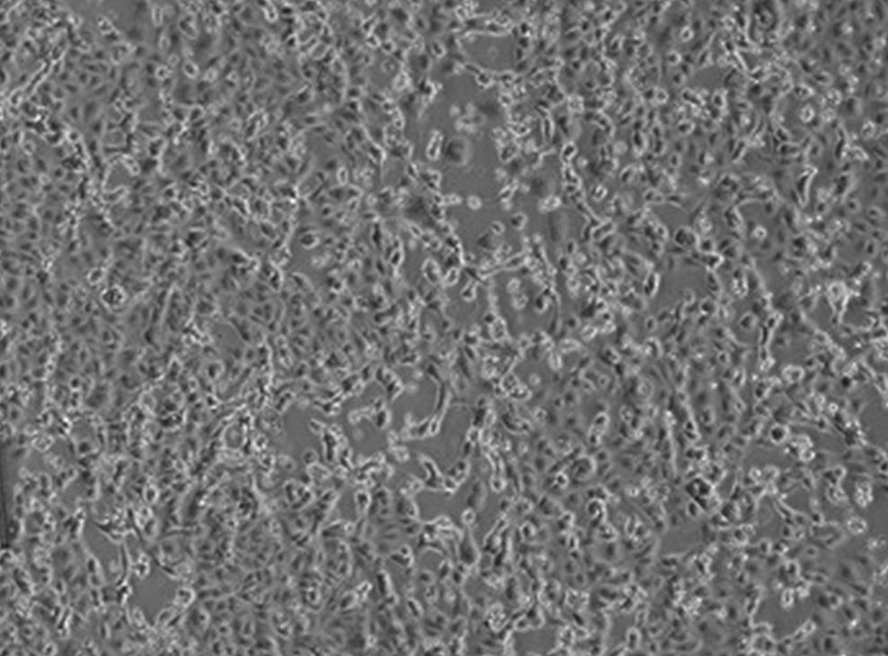 Coronavirus, positivo un italiano rimpatriato da Wuhan