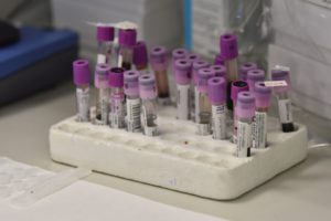 ROMA (ITALPRESS) - C'e' un'ipotesi sui "pazienti zero" del focolaio di coronavirus Covid-19 in...