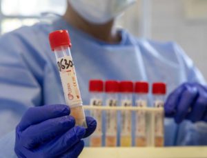 Coronavirus dati Sicilia