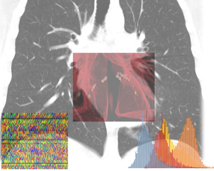 Coronavirus, intelligenza artificiale in campo per calcolare il rischio