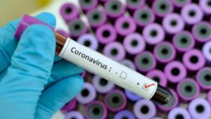 Coronavirus dati Sicilia