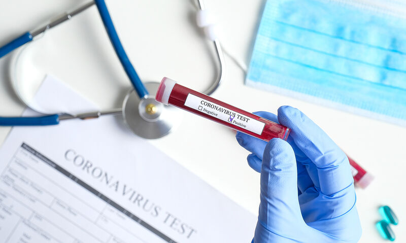 Coronavirus, i dati della Sicilia del 22 settembre: 108 nuovi contagi