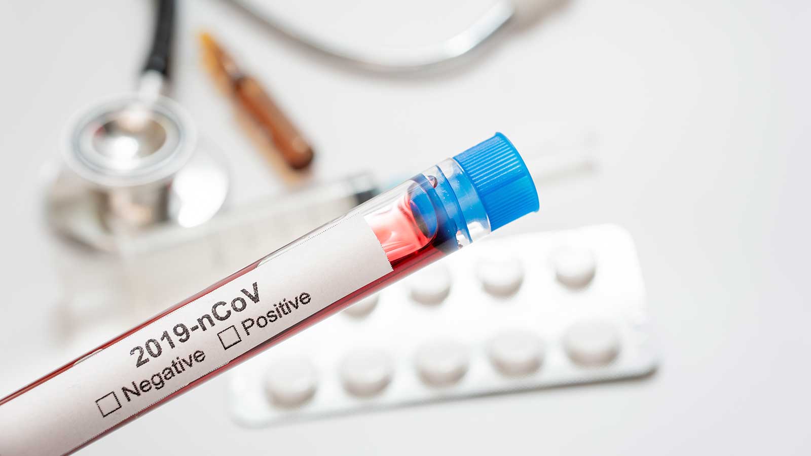 Coronavirus, i dati della Sicilia dell’8 settembre, sono 84 i nuovi positivi