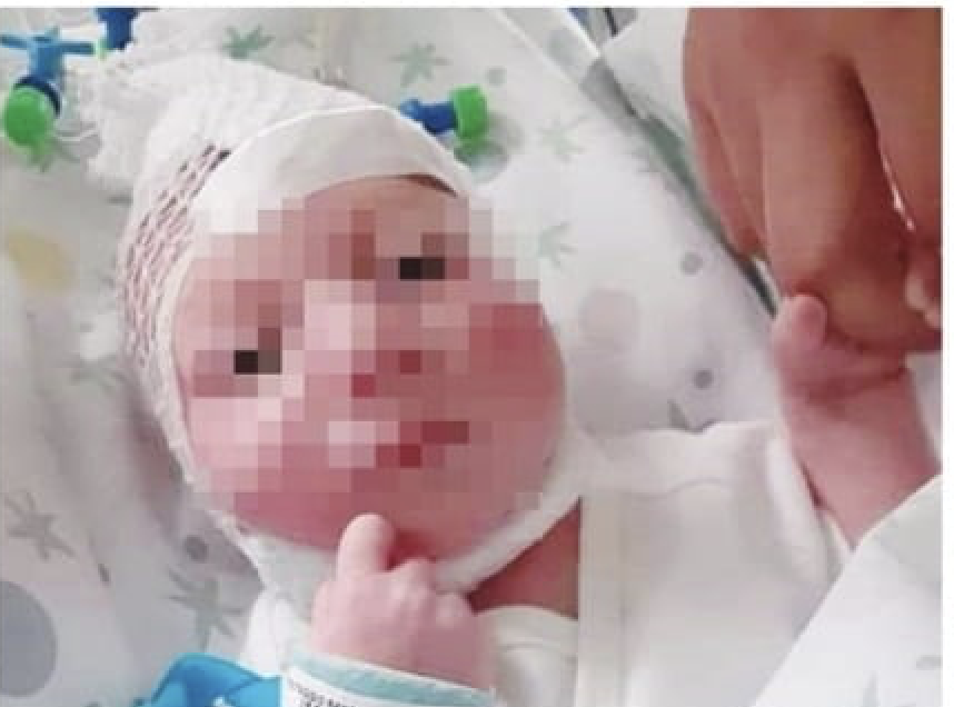 Bimbo nato con due teste, sta bene: il miracolo di Santiago