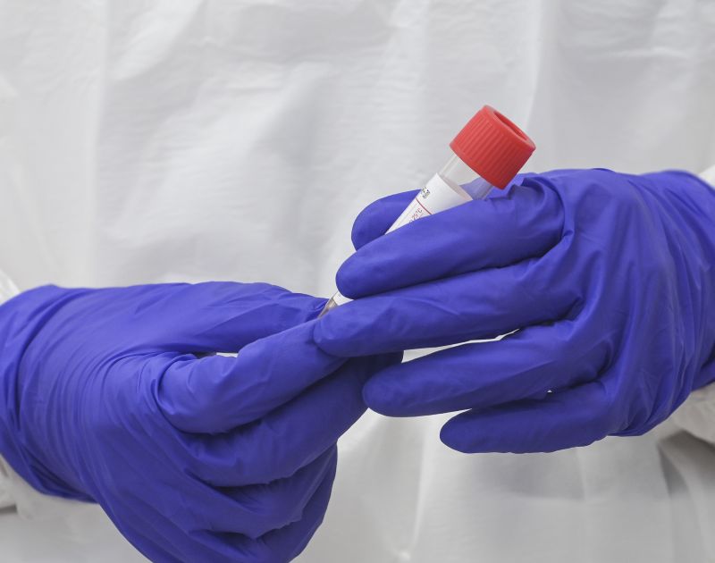 Covid in Sicilia: +32,9% di contagi rispetto alla settimana precedente