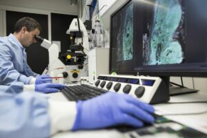 MONZA (ITALPRESS) - Roche lancia in Italia un nuovo trattamento efficace sulle tipologie più diffuse...