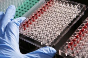 MILANO (ITALPRESS) – Sono stati premiati i vincitori del bando di finanziamento alla ricerca...