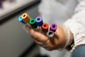 ROMA (ITALPRESS) – Sale l’incidenza settimanale a livello nazionale: 222 ogni 100.000 abitanti...