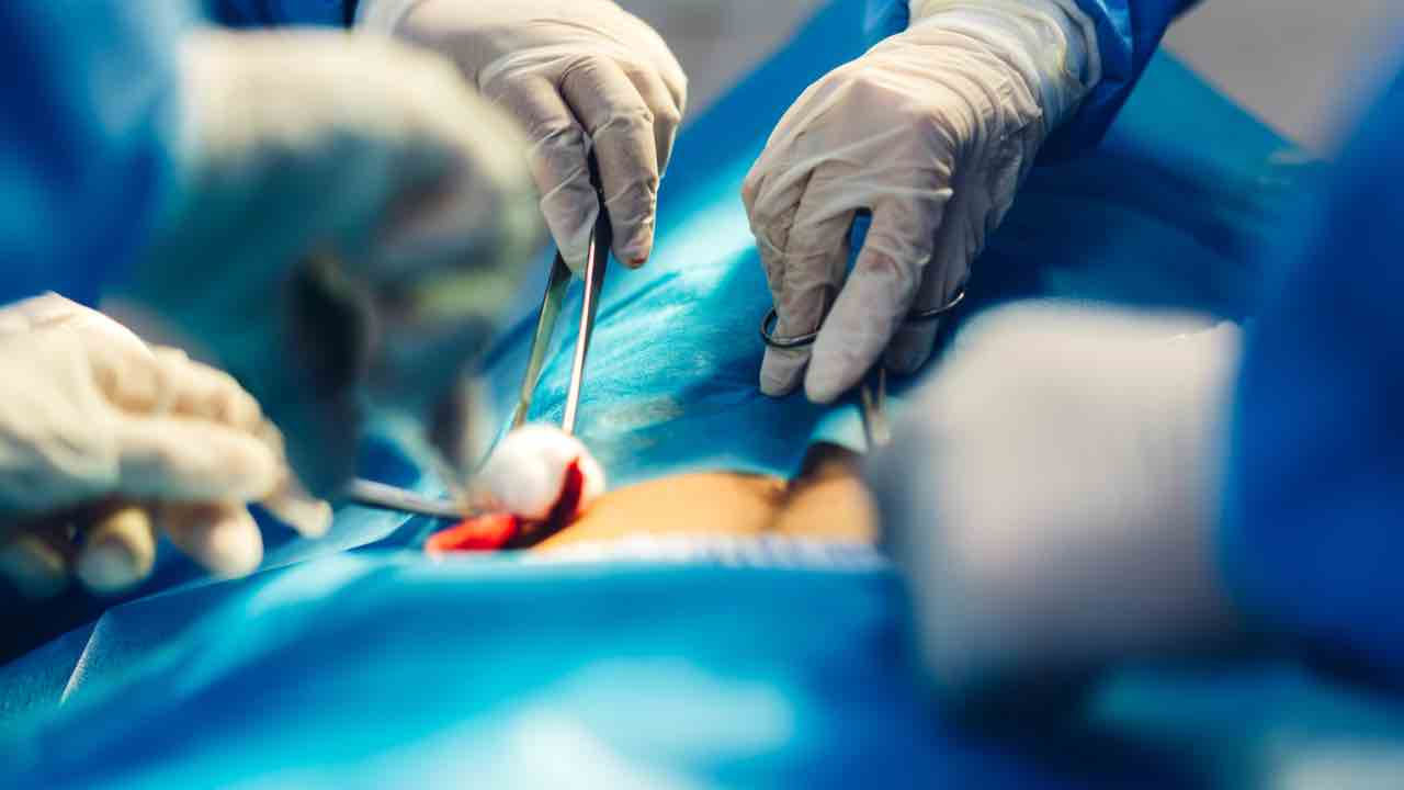 Chirurgia - sicilianews24.it