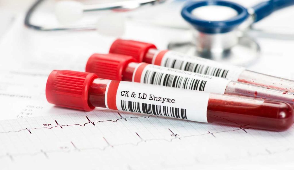 Allarme Sicilia, “C’è un’epidemia in corso, colpisce il cuore”: o fate questo esame del sangue o finite su un un letto di ospedale