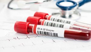 Esame del sangue - fonte_Canva -sicilianews24.it