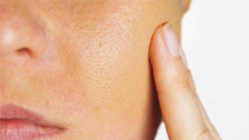 Riduci i pori dilatati: 7 consigli efficaci per una pelle naturale e sana.